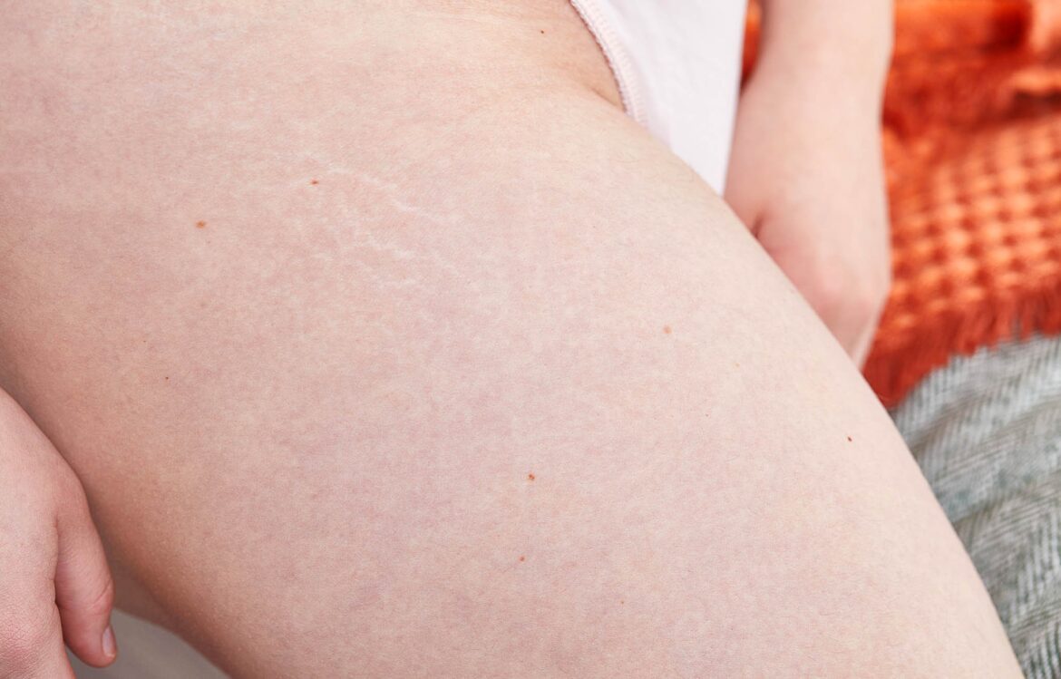 EMBRACING YOUR POST-BABY BODY – Tropic Skincare EMBRACING YOUR POST-BABY BODY – Tropic Skincare