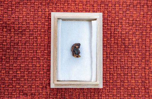 A photo of the umbilical cord in a wooden box.