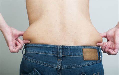 Can You Donate Skin After Weight Loss