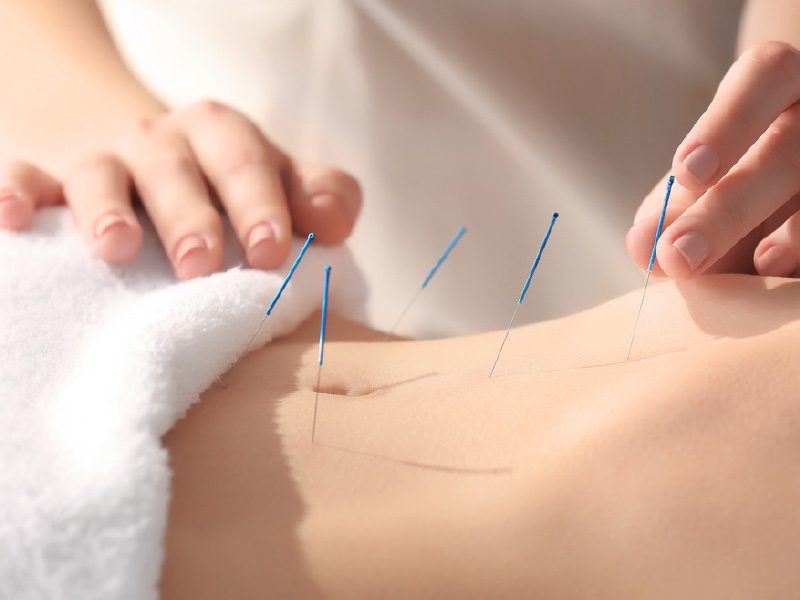 Does Acupressure Work For Weight Loss