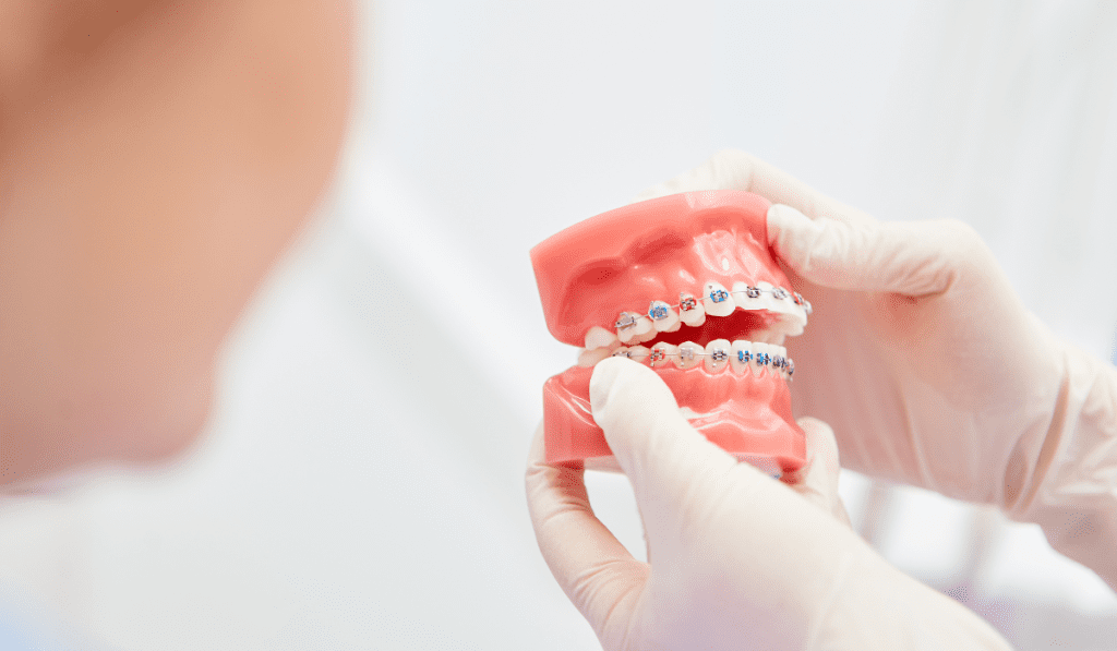 Can you Sleep with Your Dentures in Wellness Voice